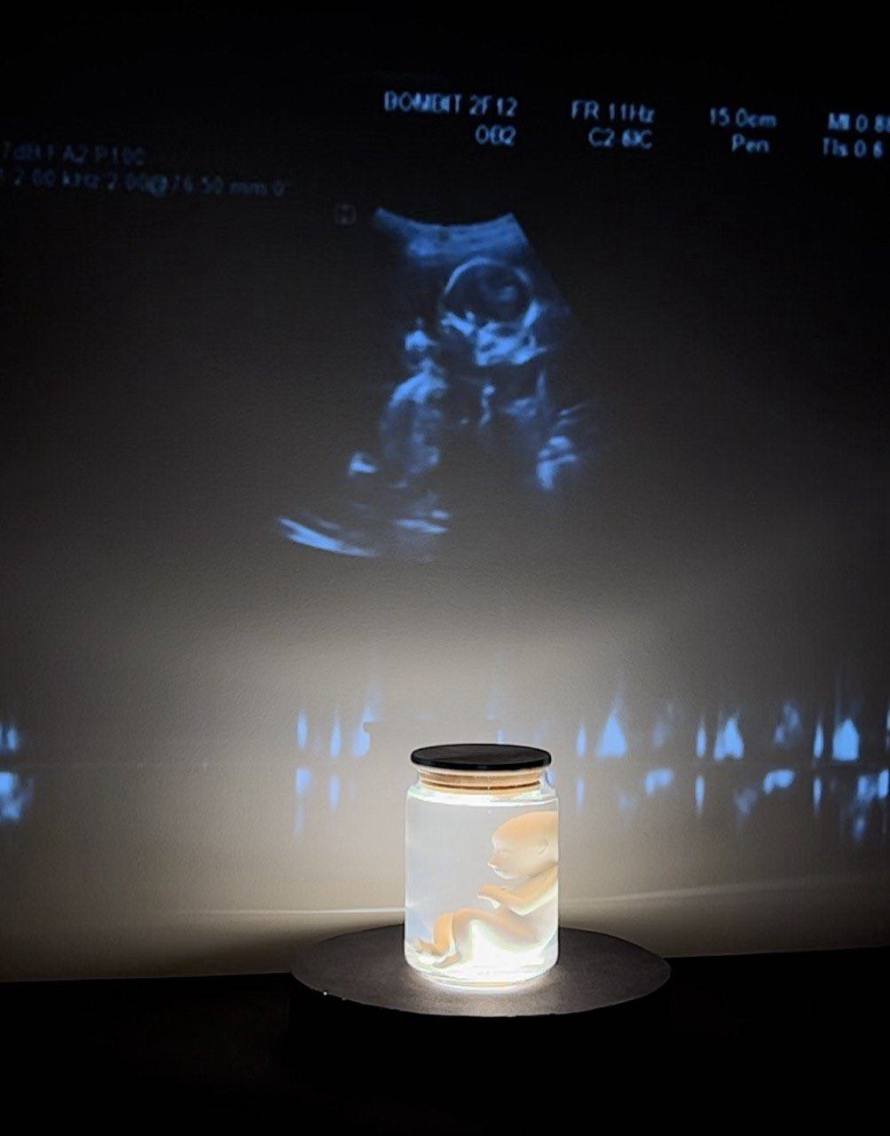 جنین در سیلیکات سدیم | | خرید تابلو جنین در سیلیکات سدیم | | خرید تابلو